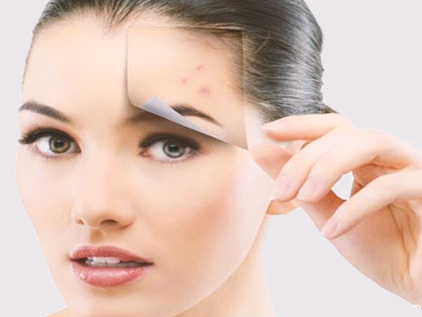 راههایی برای از بین بردن جای زخم